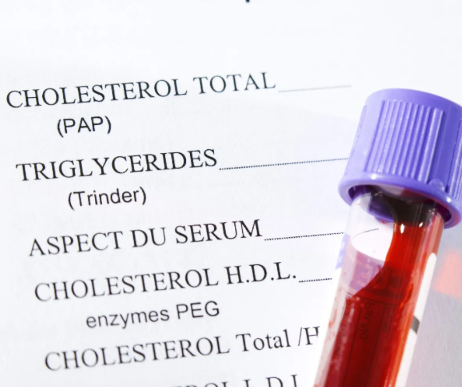 Cholesterol